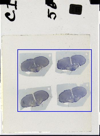 Media type: image; Special Collections 3298   shows specimen_part histological serial section;